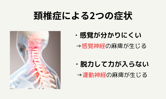頸椎症による2つの症状